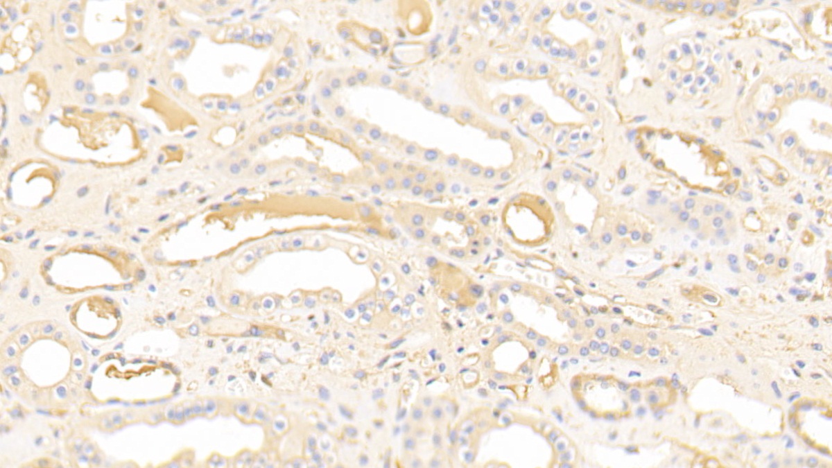 Nucleobindin 1 (NUCB1) Human Polyclonal Antibody