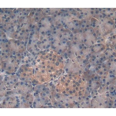 Mannosyl Oligosaccharide Glucosidase (MOGS) Human Polyclonal Antibody