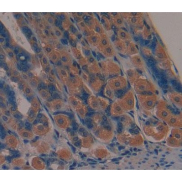 Mannosyl Oligosaccharide Glucosidase (MOGS) Mouse Polyclonal Antibody