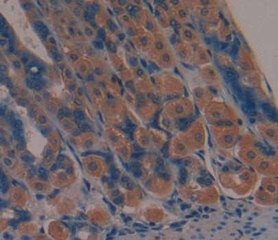 Mannosyl Oligosaccharide Glucosidase (MOGS) Mouse Polyclonal Antibody