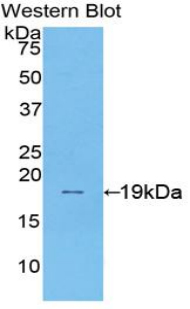 Sucrase Isomaltase (SI) Human Polyclonal Antibody