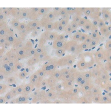 Glycogen Debranching Enzyme (AGL) Human Polyclonal Antibody