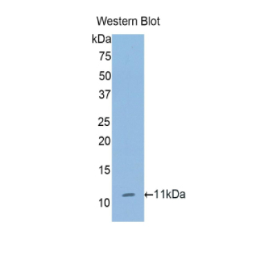 Collagen Type II Alpha 1 (COL2a1) Human Polyclonal Antibody