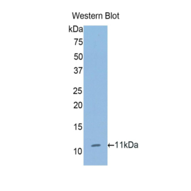 Collagen Type II Alpha 1 (COL2a1) Human Polyclonal Antibody
