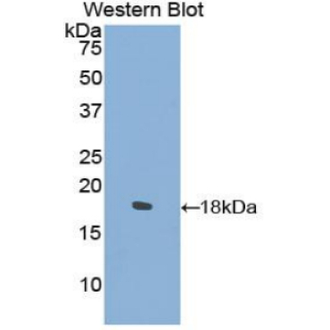 Collagen Type II Alpha 1 (COL2a1) Mouse Polyclonal Antibody