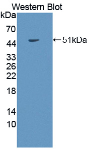 Collagen Type II Alpha 1 (COL2a1) Rabbit Polyclonal Antibody