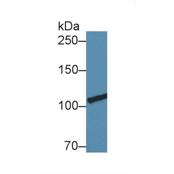 Collagen Type III Alpha 1 (COL3a1) Human Polyclonal Antibody