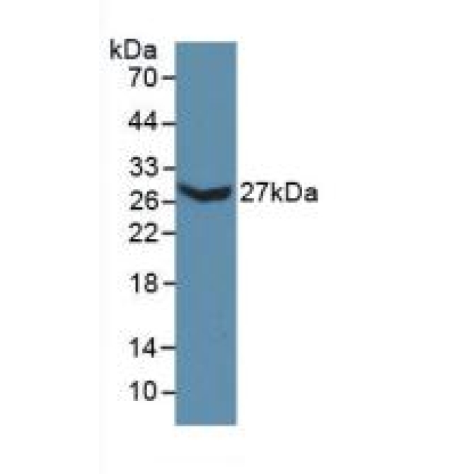 Collagen Type III Alpha 1 (COL3a1) Mouse Polyclonal Antibody
