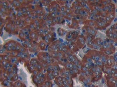Collagen Type III Alpha 1 (COL3a1) Rat Polyclonal Antibody