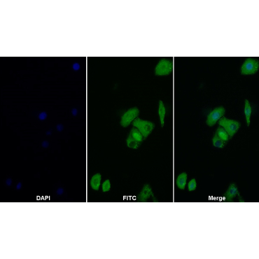 Sequestosome 1 (SQSTM1) Human Polyclonal Antibody