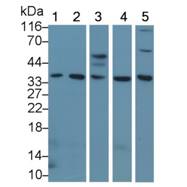 Epstein Barr Virus Induced Protein 3 (EBI3) Human Polyclonal Antibody