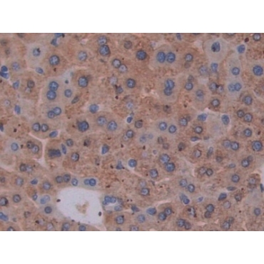 Epstein Barr Virus Induced Protein 3 (EBI3) Mouse Polyclonal Antibody