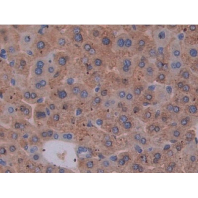 Epstein Barr Virus Induced Protein 3 (EBI3) Mouse Polyclonal Antibody