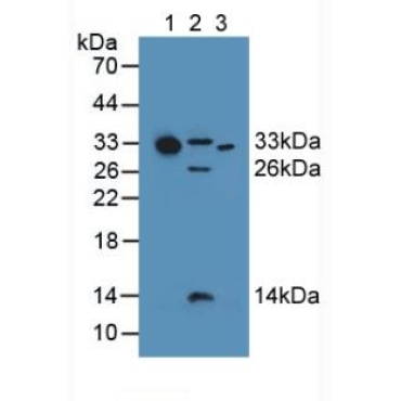 Complement Component 1, Q Subcomponent A (C1qA) Human Polyclonal Antibody
