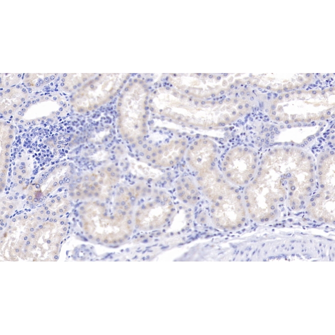 Complement Component 1, Q Subcomponent B (C1qB) Human Polyclonal Antibody