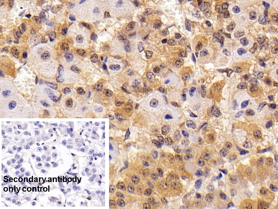 Thyroid Stimulating Hormone Beta (TSHb) Rat Polyclonal Antibody