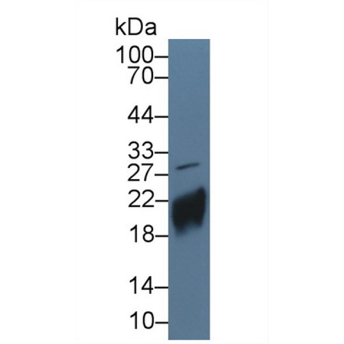 Chorionic Gonadotropin Beta Polypeptide (CGb) Human Polyclonal Antibody