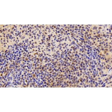 Prothymosin Alpha (PTMa) Human Polyclonal Antibody