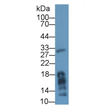 Lipase, Monoacylglycerol (MGL) Human Polyclonal Antibody