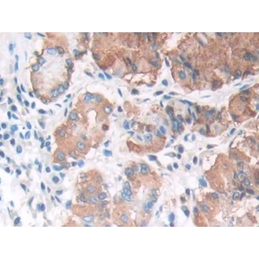 Lipase, Gastric (LIPF) Human Polyclonal Antibody