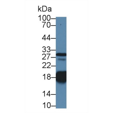 Troponin C Type 1, Slow (TNNC1) Human Polyclonal Antibody