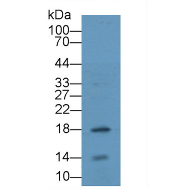 Troponin C Type 2, Fast (TNNC2) Human Polyclonal Antibody