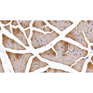 Troponin I Type 2, Fast Skeletal (TNNI2) Human Polyclonal Antibody