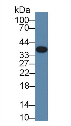 Troponin T Type 1, Slow Skeletal (TNNT1) Mouse Polyclonal Antibody