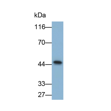 Troponin T Type 2, Cardiac (TNNT2) Human Polyclonal Antibody