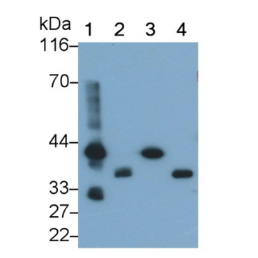 Troponin T Type 2, Cardiac (TNNT2) Human Polyclonal Antibody