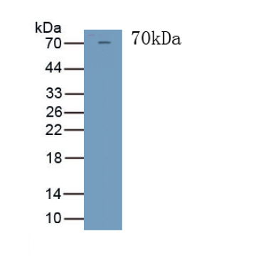 Troponin T Type 2, Cardiac (TNNT2) Human Polyclonal Antibody