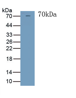 Troponin T Type 2, Cardiac (TNNT2) Human Polyclonal Antibody