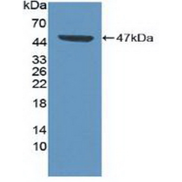 Cyclin Dependent Kinase 8 (CDK8) Human Polyclonal Antibody