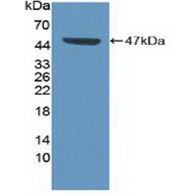 Cyclin Dependent Kinase 8 (CDK8) Human Polyclonal Antibody