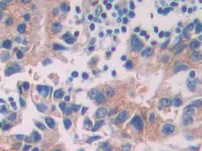 Tyrosine Protein Kinase 7 (PTK7) Human Polyclonal Antibody