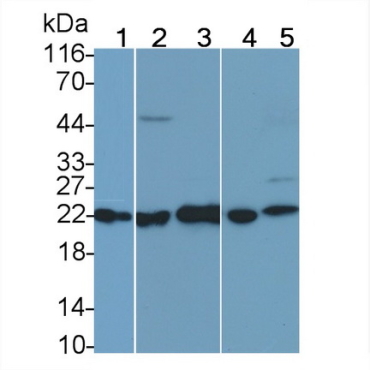 Ferritin, Mitochondrial (FTMT) Human Polyclonal Antibody