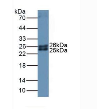 Ferritin, Mitochondrial (FTMT) Mouse Polyclonal Antibody