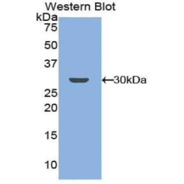 G Protein Coupled Receptor Kinase 5 (GRK5) Human Polyclonal Antibody