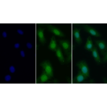 Cyclin A1 (CCNA1) Human Polyclonal Antibody
