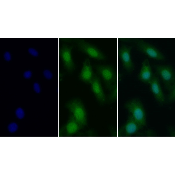 Cyclin A1 (CCNA1) Human Polyclonal Antibody