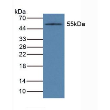 Cytochrome P450 1A1 (CYP1A1) Human Polyclonal Antibody