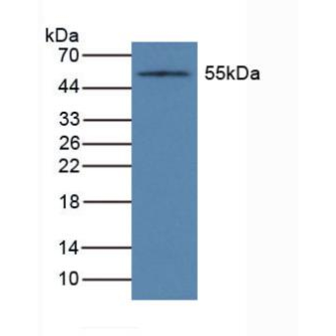 Cytochrome P450 1A1 (CYP1A1) Human Polyclonal Antibody