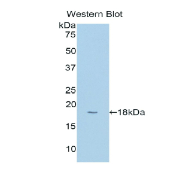 Cytochrome P450 1B1 (CYP1B1) Human Polyclonal Antibody
