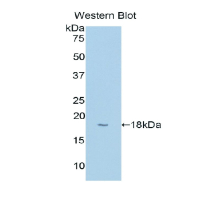 Cytochrome P450 1B1 (CYP1B1) Human Polyclonal Antibody