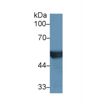 Cytochrome P450 2D6 (CYP2D6) Human Polyclonal Antibody