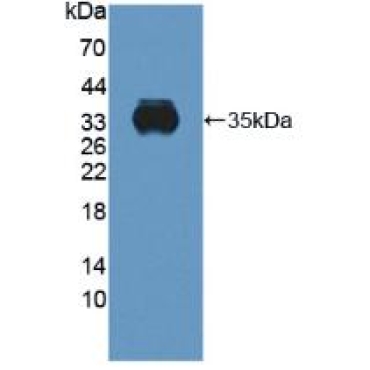 Cytochrome b-245 Beta Polypeptide (CYBb) Human Polyclonal Antibody