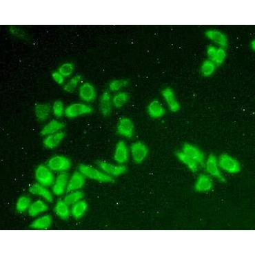 Holocytochrome C Synthase (HCCS) Human Polyclonal Antibody