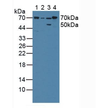 Cytochrome P450 Reductase (CPR) Human Polyclonal Antibody