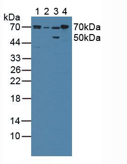 Cytochrome P450 Reductase (CPR) Human Polyclonal Antibody