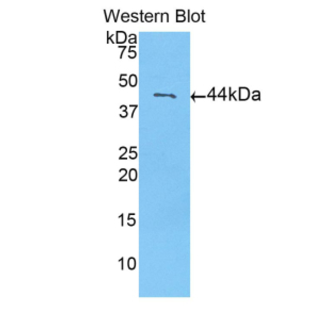 Calmodulin 1 (CALM1) Human Polyclonal Antibody
